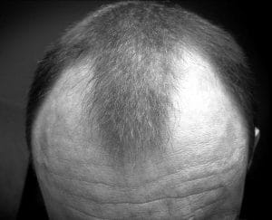 a man with hair curves