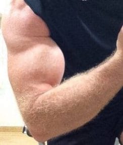 Male biceps