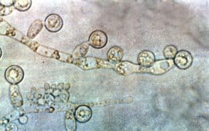 Candida albicans fungi