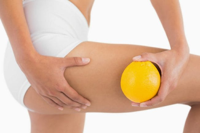  Smooth thighs of a woman without cellulite, next to an orange held in her hand
