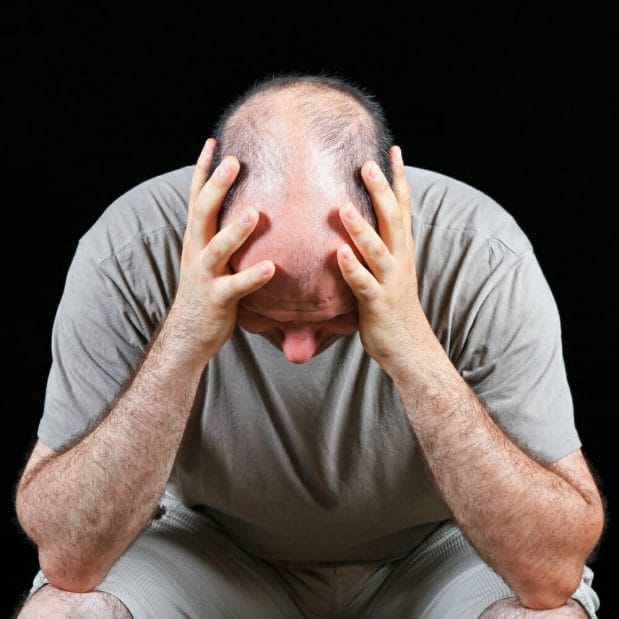 balding man