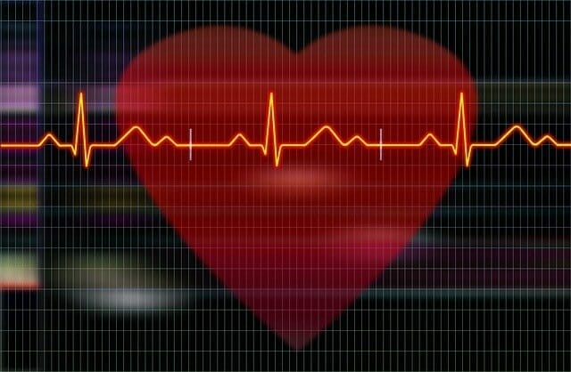 Graphic showing the heart and electrocardiograph recordings