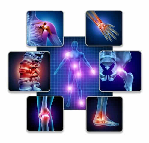 A graphic showing the location of joints in the human body
