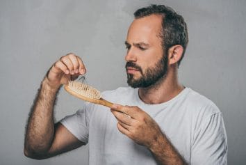 male hair loss
