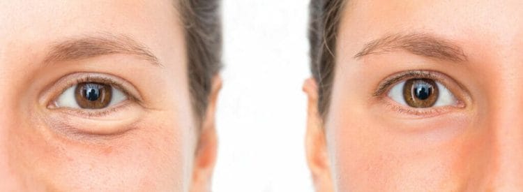 The effect of the anti-wrinkle serum