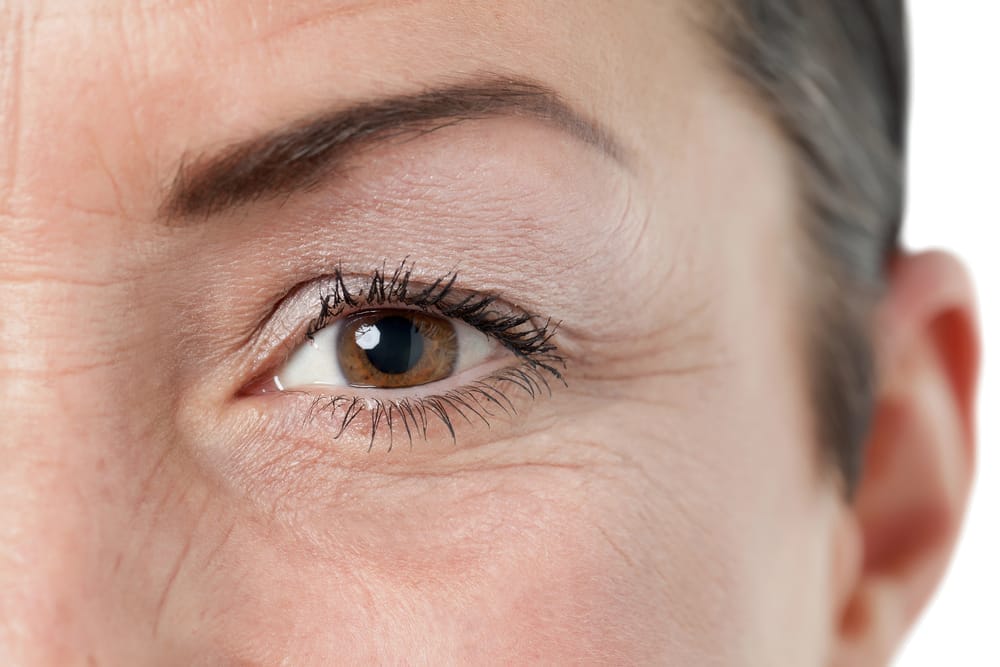  Close-up of the eye and under-eye wrinkles